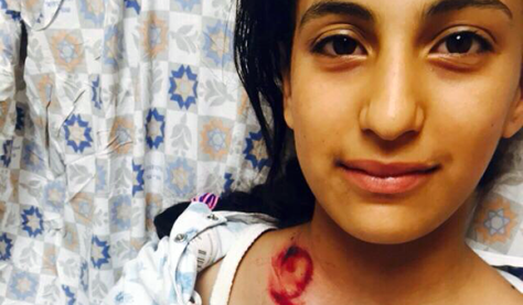 Aseel Muheisen, 12, ha sofferto una clavicola rotta da un nero, proiettile di plastica spugna con punta utilizzato dalla polizia israeliana a Gerusalemme.